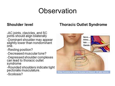 shoulder depression test positive